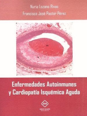 ENFERMEDADES AUTOINMUNES Y CARDIOPATIA ISQUEMICA AGUDA