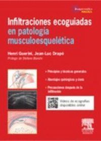 INFILTRACIONES ECOAGUDAS EN PATOLOGIA MUSCULOESQUELETICA