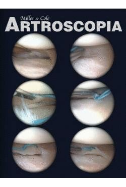 ARTROSCOPIA