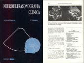 NEUROULTRASONOGRAFIA CLINICA