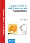 CANCER VESICAL QUE NO INFILTRA MUSCULO