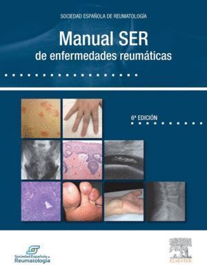 MANUAL SER DE ENFERMEDADES REUMATICAS 2014