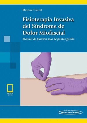 FISIOTERAPIA INVASIVA DEL SINDROME DE DOLOR MIOFASCIAL+EBOOK
