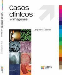 CASOS CLINICOS EN IMAGENES