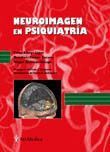 NEUROIMAGEN EN PSIQUIATRIA