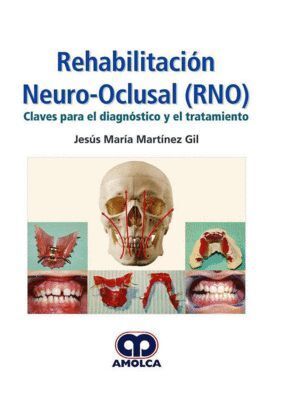 REHABILITACION NEURO-OCLUSAL RNO DIAGNOSTICO Y TRATAMIENTO