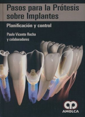PASOS PARA LA PROTESIS SOBRE IMPLANTES